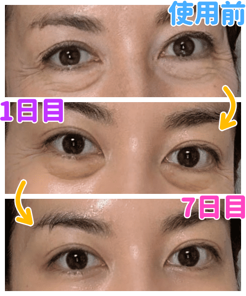 目元のハリとツヤ復活